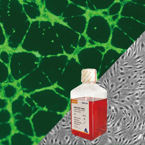 Human Umbilical Vein Endothelial Cell Line