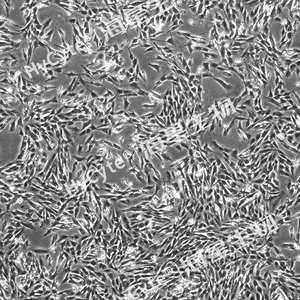 TERT-SV40 转化的人胚肺细胞(MRC-5/TERT-SV40)