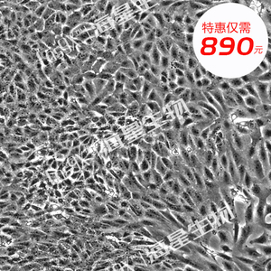非洲绿猴肾细胞（VERO E6）特价送培养基