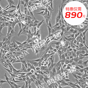 大鼠肝星形细胞(HSC-T6)