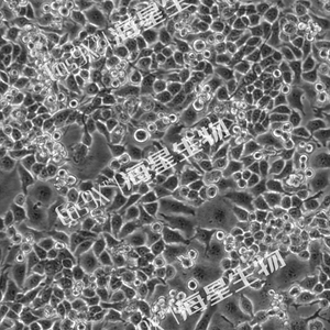 KM小鼠脑神经胶质母细胞瘤瘤株(G422)